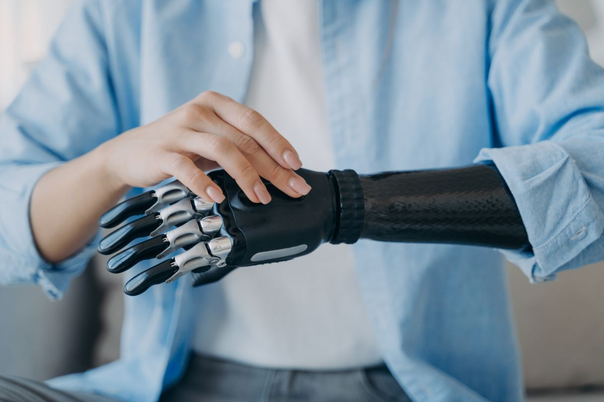 Person in blue shirt examining a carbon-fiber robotic prosthetic arm